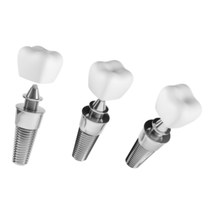 Dental Implants